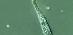 Trachelophyllum brachypharynx