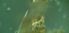 Trachelophyllum brachypharynx