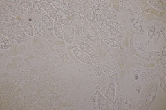 Paranectria oropensis