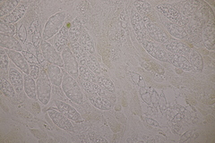 Paranectria oropensis