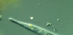 Trachelophyllum brachypharynx