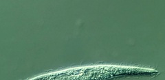 Trachelophyllum brachypharynx