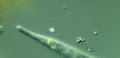 Trachelophyllum brachypharynx