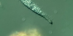 Trachelophyllum brachypharynx