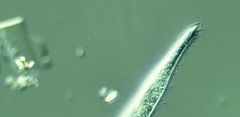 Trachelophyllum brachypharynx