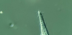Trachelophyllum brachypharynx