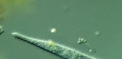 Trachelophyllum brachypharynx