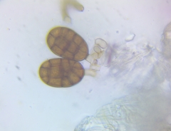 Berkleasmium concinnum