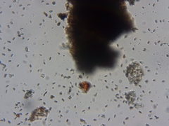 Mycocalicium subtile