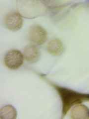 Symphytocarpus trechisporus