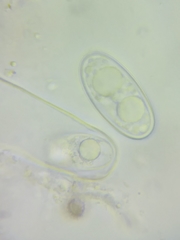 Pachyella clypeata image