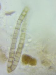 Pachyella clypeata image