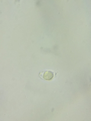 Neohygrocybe