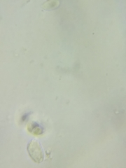 Neohygrocybe