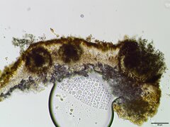 Lichenoconium xanthoriae