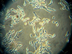 Ionomidotis irregularis