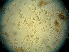 Ionomidotis irregularis