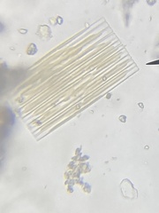 Fragilaria