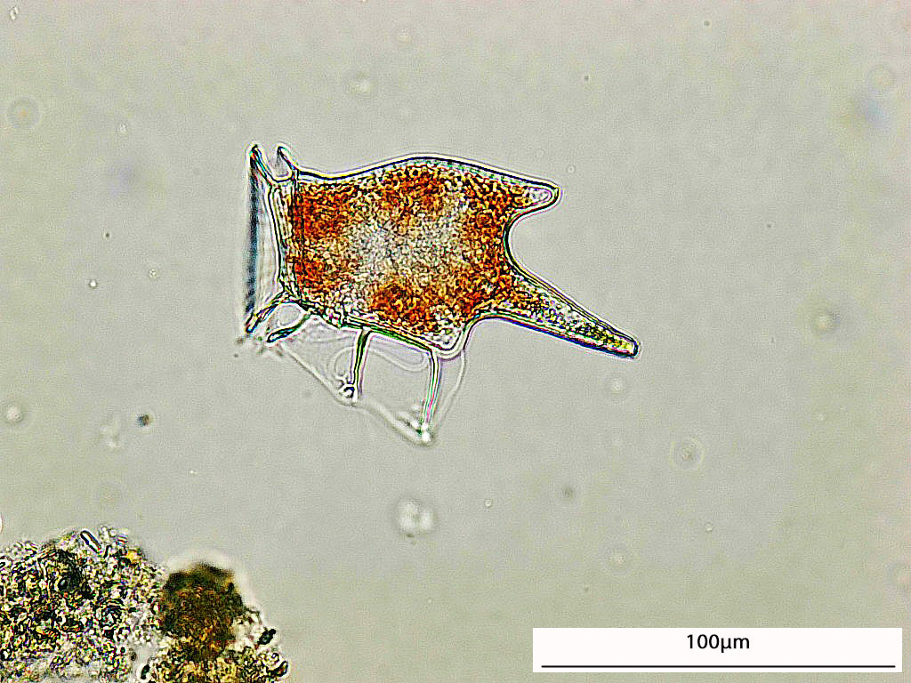 Dinophysis tripos