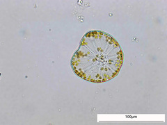 Asteromphalus
