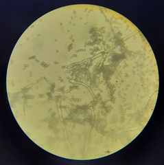 Aspergillus niger