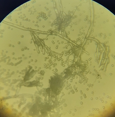 Aspergillus niger