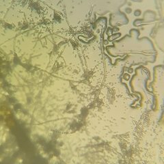 Aspergillus niger
