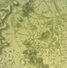 Aspergillus niger
