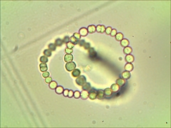 Anabaena spiroides