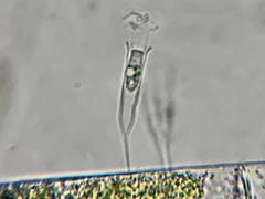 Salpingoeca gracilis