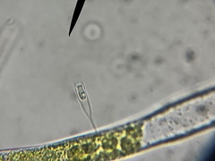 Salpingoeca gracilis