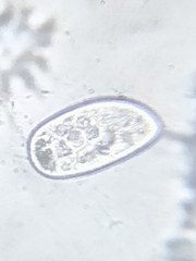 Paramecium