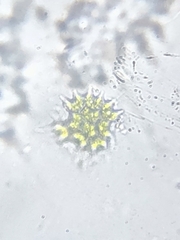 Pseudopediastrum boryanum