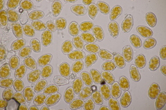 Melampsoridium carpini