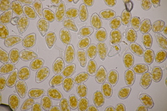 Melampsoridium carpini