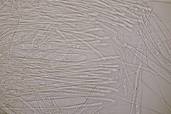 Lachnellula occidentalis