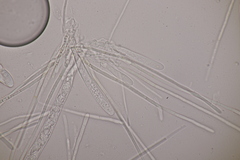 Lachnellula occidentalis