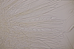 Lachnellula occidentalis