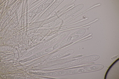 Lachnellula occidentalis