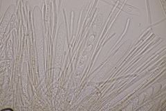 Lachnellula occidentalis