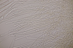 Lachnellula occidentalis