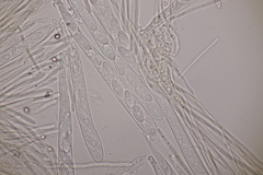 Lachnellula occidentalis