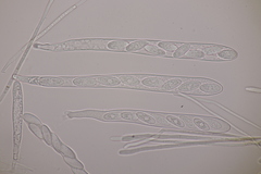 Lachnellula occidentalis