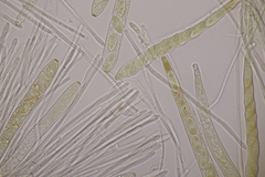 Lachnellula occidentalis