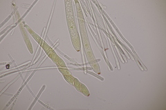 Lachnellula occidentalis