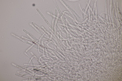 Lachnellula occidentalis