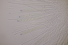 Lachnellula occidentalis