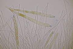 Lachnellula occidentalis