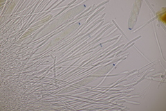 Lachnellula occidentalis