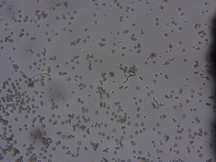 Chaenotheca brunneola